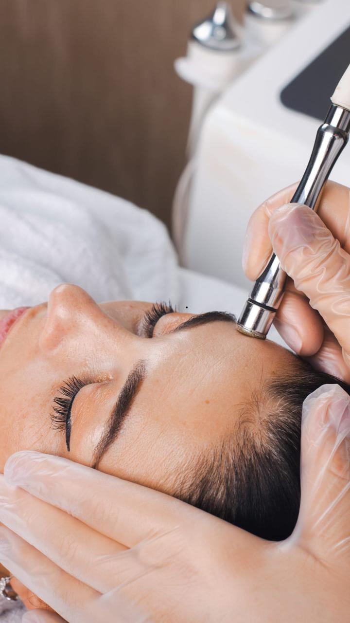 Microdermabrasion Treatment