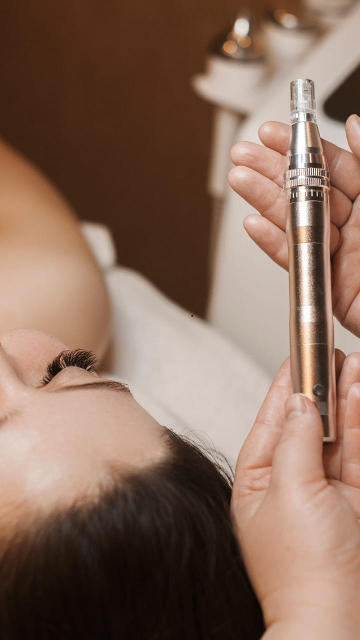 Microneedling Treatment